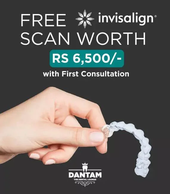 Invisalign Offer