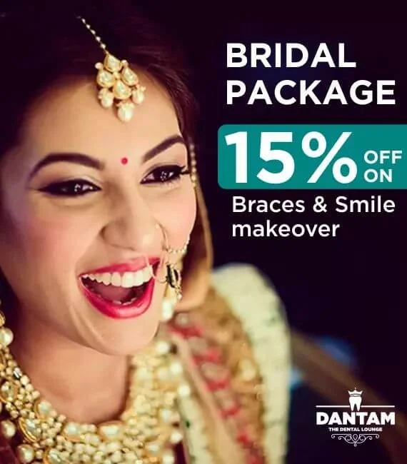Invisalign Offer